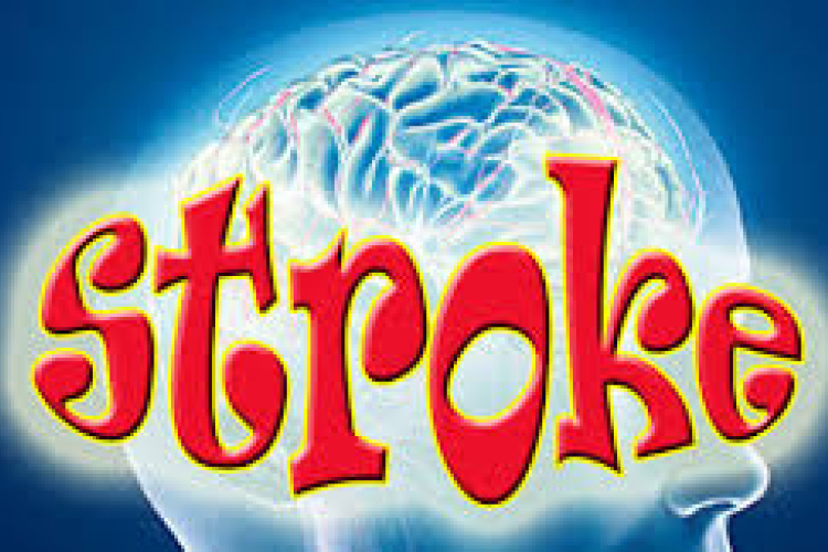 Stroke, az egyik vezető megbetegedés Magyarországon