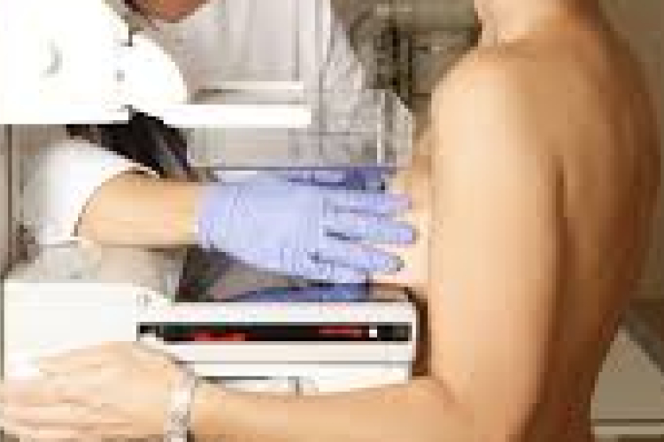 Ismét mobil mammográfia