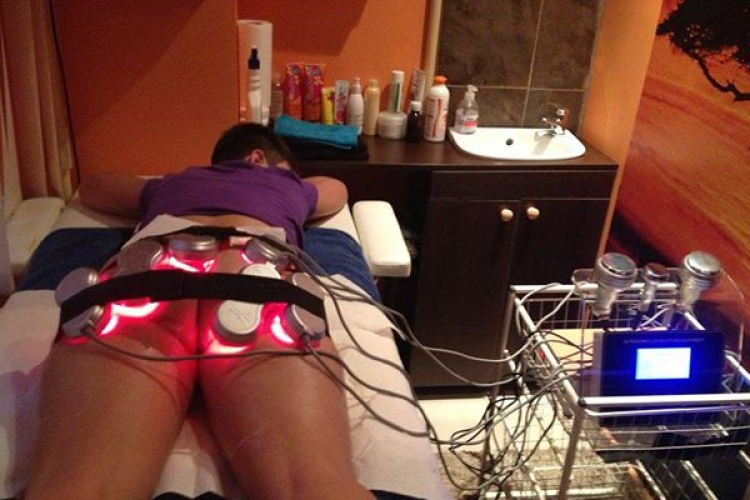 Mikor válasszak kavitációs ultrahangos zsírbontó kezelést?